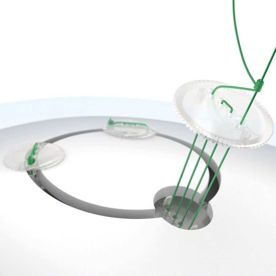 Cranial Fixation Neuro Plating System2 1 900x900
